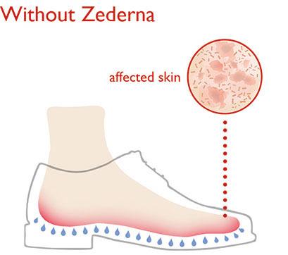 Healthy skin and no smelly feet with cedar wood insoles